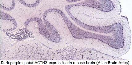 File:ACTN3 brain exp.jpg